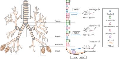 Epigenetic regulation of stem cells in lung cancer oncogenesis and therapy resistance